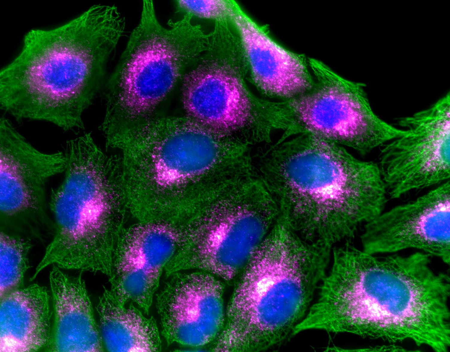 airway cells tubulin green eNOS pink nuclei blue